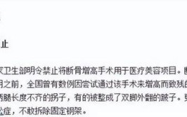 北京小伙花16万断骨增高7.2厘米，现在生活在极度痛苦当中(李亚增高小伙生活手术)