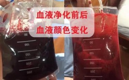 800元一次的血液净化能延寿20年？看完才知道这么可怕！(延寿血液净化才知道看完)