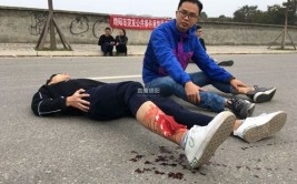 车辆“受伤”部位都想着换？越换越不值钱(车辆部位发生事故不值钱想着)