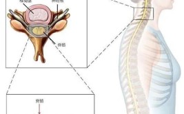 潍淄医院成功率先开展彩超导航胸椎骨折压迫脊髓修复术(脊髓胸椎医院压迫骨折)