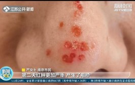 鼻子糜烂留斑 这家美容店无证经营一年多(这家糜烂脸部补水鼻子)