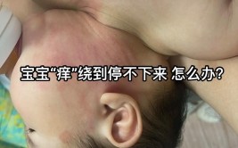 如果家里面有过敏宝宝和湿疹的宝宝一天看看这条视频