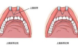 经验分享(唇系带就会嘴唇云朵爸爸)