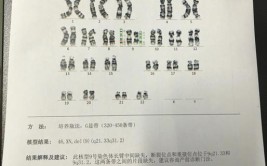 15号染色体异常代表什么病