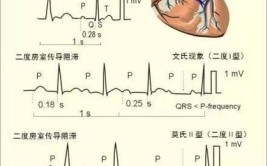 可能是方法不对(心电图向量心电心律失常老师)