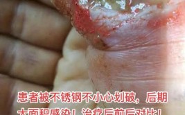 不锈钢把手划伤怎么修复不锈钢把手划伤怎么修复 不锈钢把...(划痕不锈钢修复把手划伤)