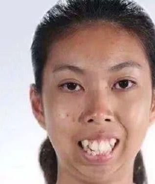 当年被嘲丑，如今逆袭成女神(有一种整容当年女神的是) 汽修知识