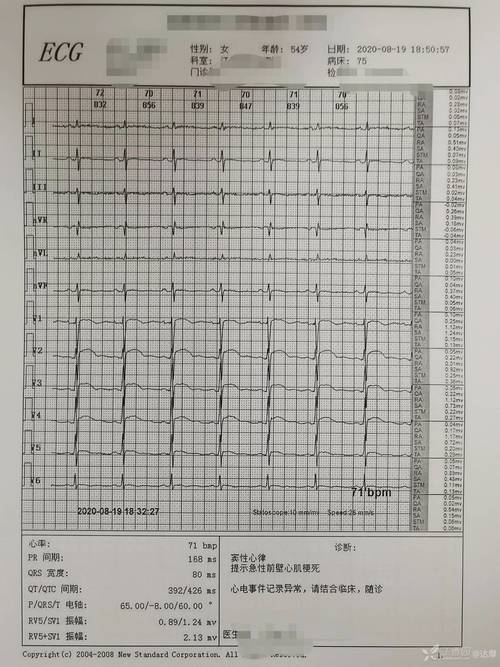 医生坚持电话“轰炸”最终抢回男子一条命(心电图师傅心肌梗死轰炸医生) 汽修知识