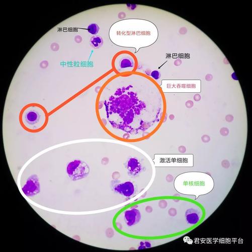 单核细胞和巨噬细胞区别 学类资讯