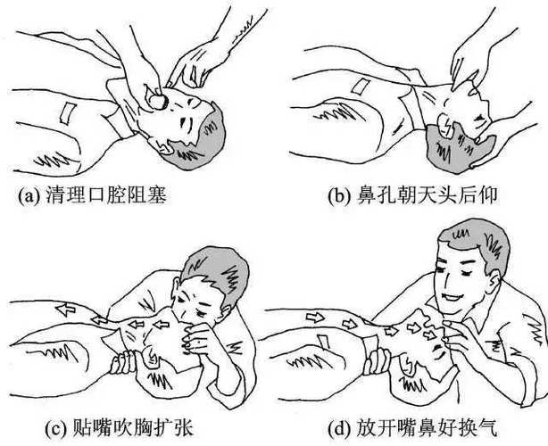 第一个提出人工呼吸法的著作是什么 学类资讯