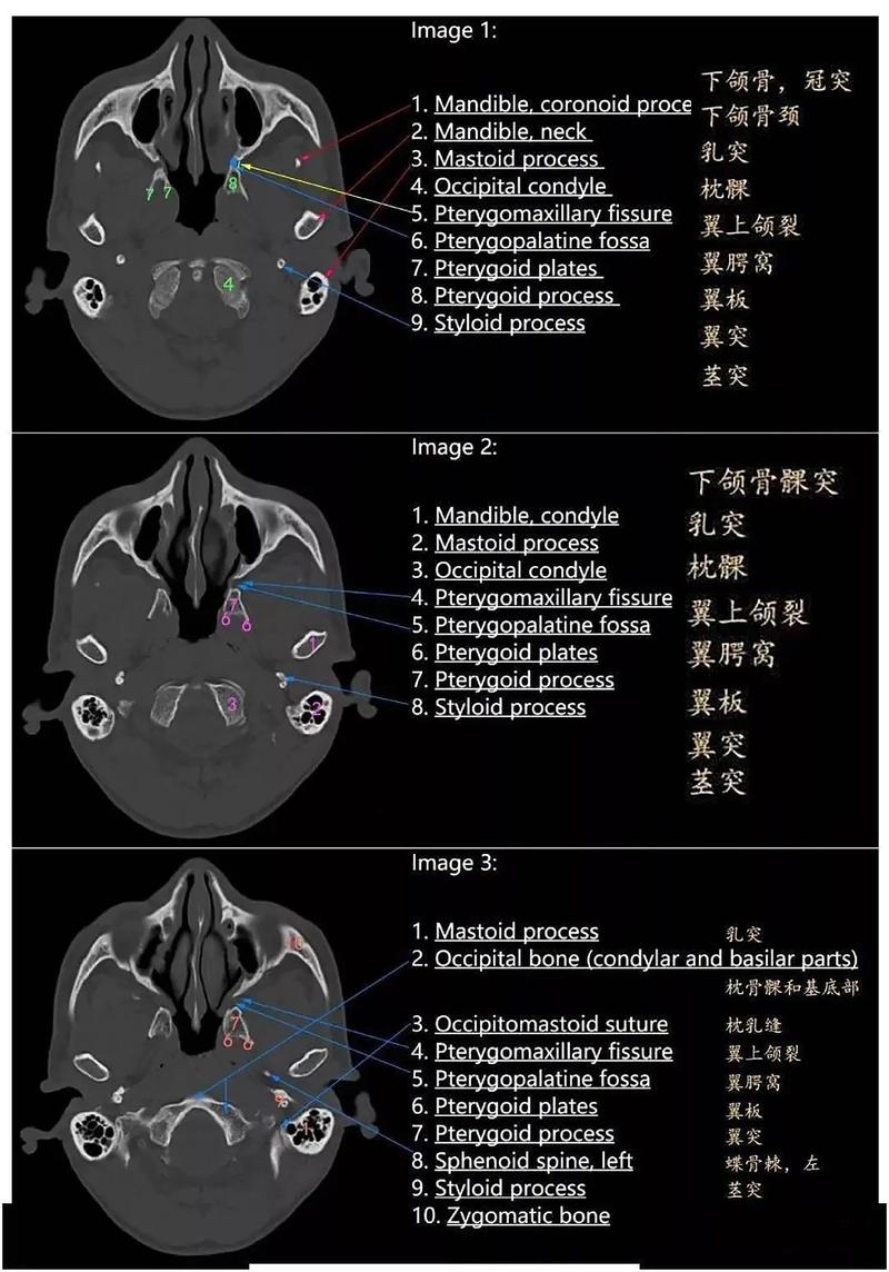 放射医学和医学影像学区别 学类资讯